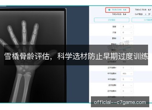 雪橇骨龄评估，科学选材防止早期过度训练